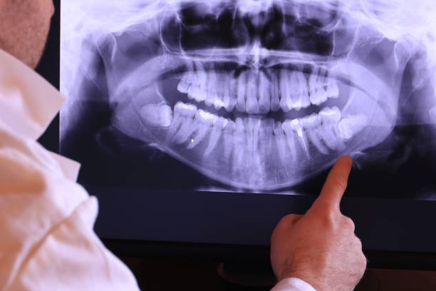 Best Emergency Tooth Extraction in New Paris, IN